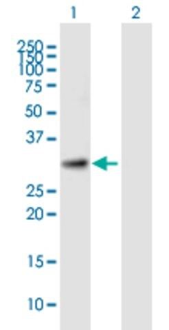 Anti-KIAA0103 antibody produced in mouse