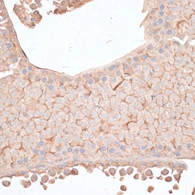 Anti-KIAA1524 antibody produced in rabbit