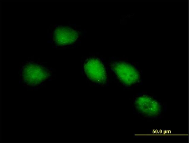 Anti-KIAA0562 antibody produced in mouse