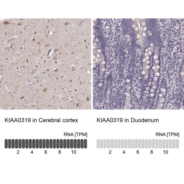 Anti-KIAA0319 antibody produced in rabbit