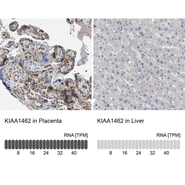 Anti-KIAA1462 antibody produced in rabbit