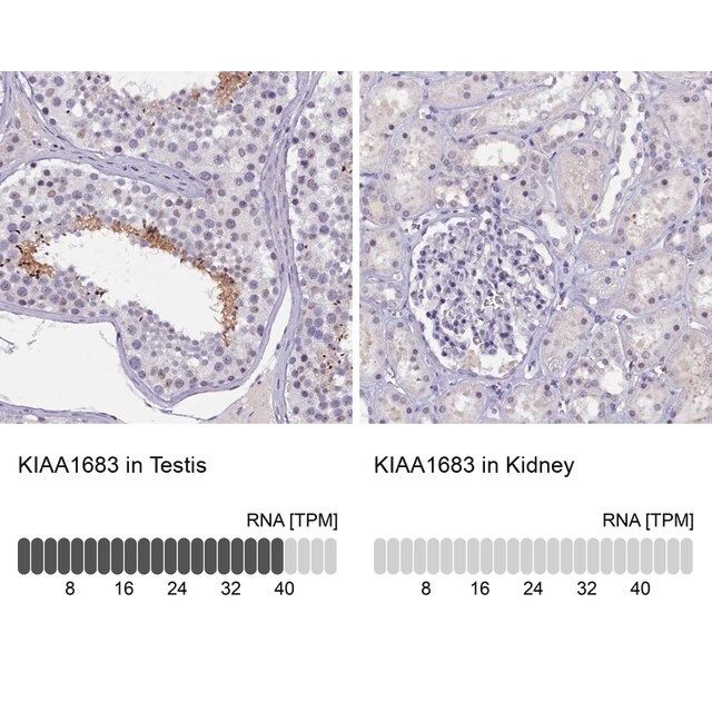 Anti-KIAA1683 antibody produced in rabbit