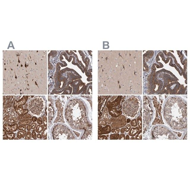 Anti-KIAA0753 antibody produced in rabbit