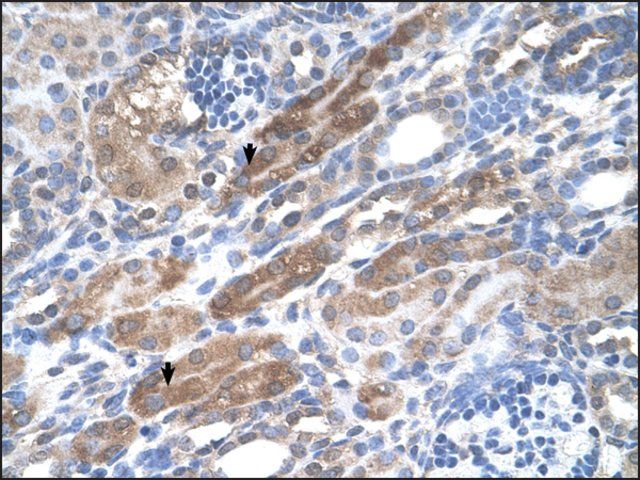 Anti-KIAA0319 antibody produced in rabbit