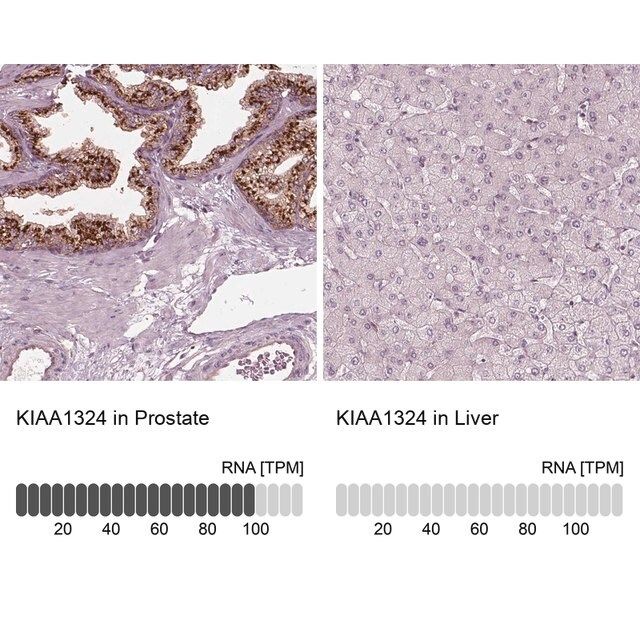 Anti-KIAA1324 antibody produced in rabbit