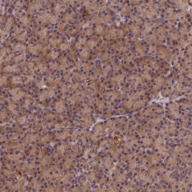 Anti-KIAA0100 antibody produced in rabbit