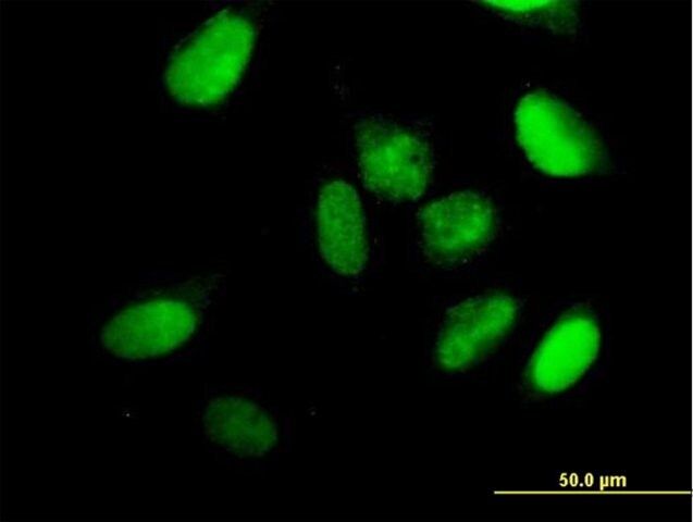 Anti-KIF22 antibody produced in mouse