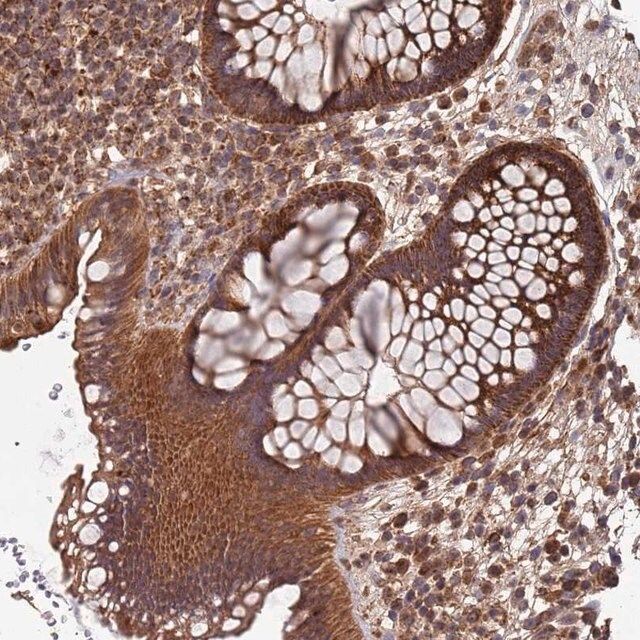 Anti-KIAA0391 antibody produced in rabbit