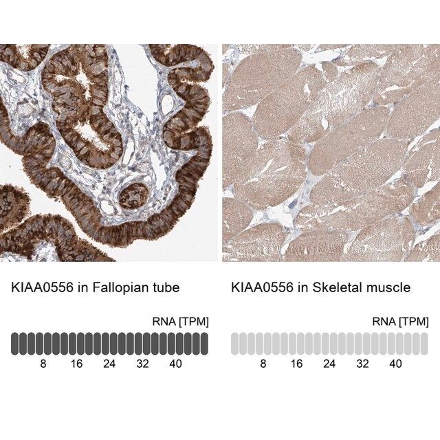 Anti-KIAA0556 antibody produced in rabbit