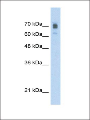 Anti-KIF22 antibody produced in rabbit