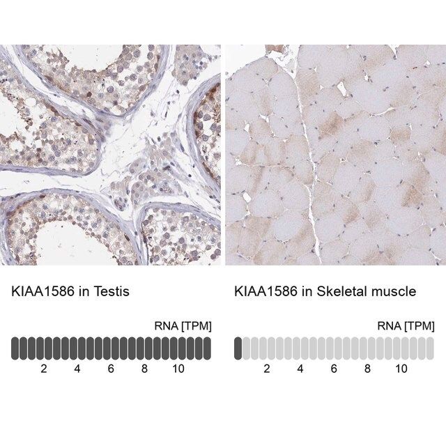 Anti-KIAA1586 antibody produced in rabbit