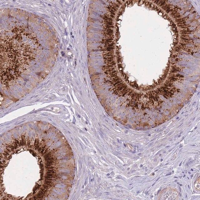 Anti-KIAA1211L antibody produced in rabbit