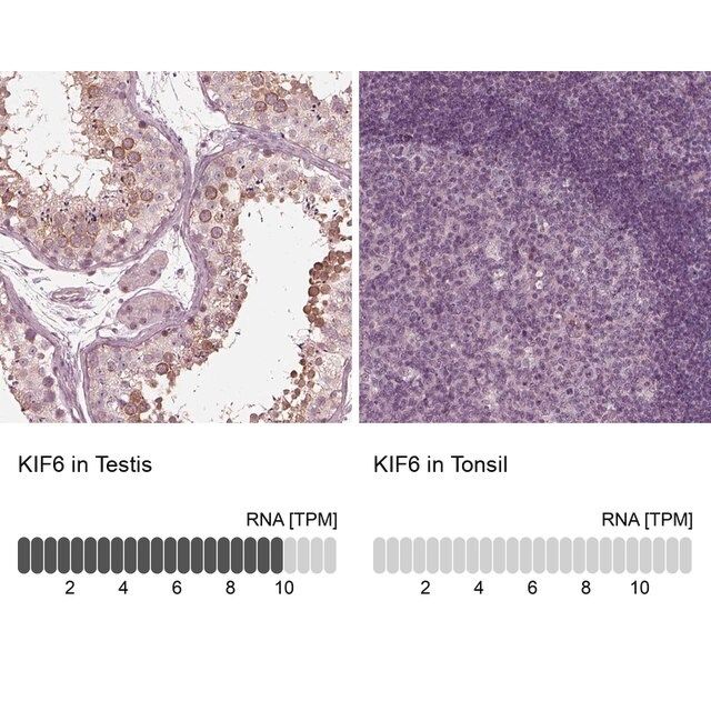 Anti-KIF6 antibody produced in rabbit