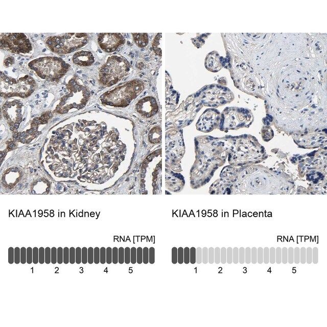 Anti-KIAA1958 antibody produced in rabbit