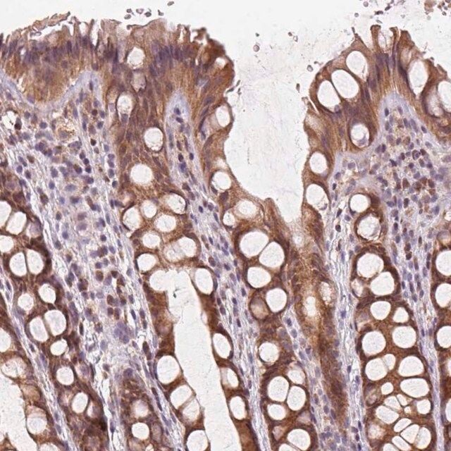 Anti-KIAA0895L antibody produced in rabbit