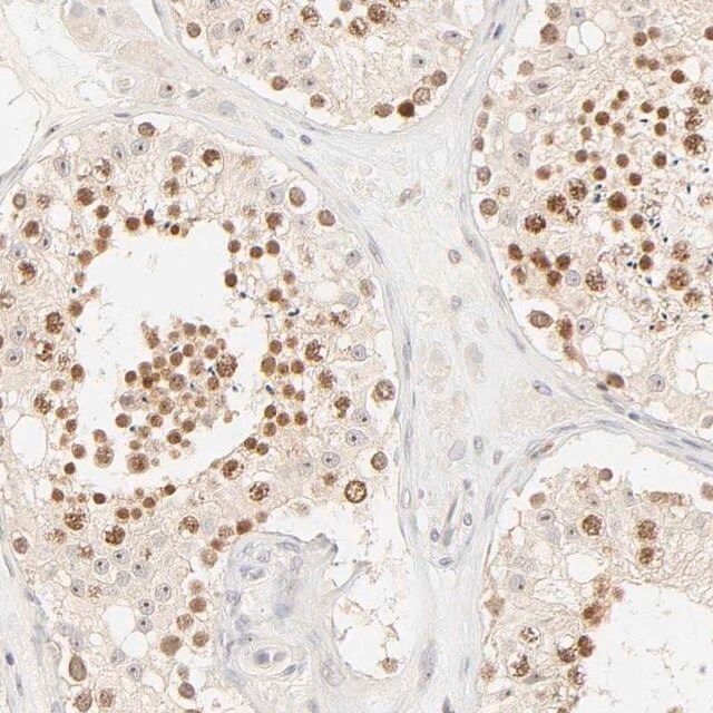 Anti-KIF2A antibody produced in rabbit