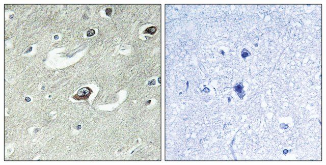 Anti-KIF20A antibody produced in rabbit