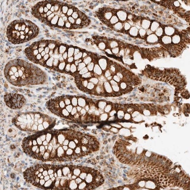 Anti-KIFAP3 antibody produced in rabbit