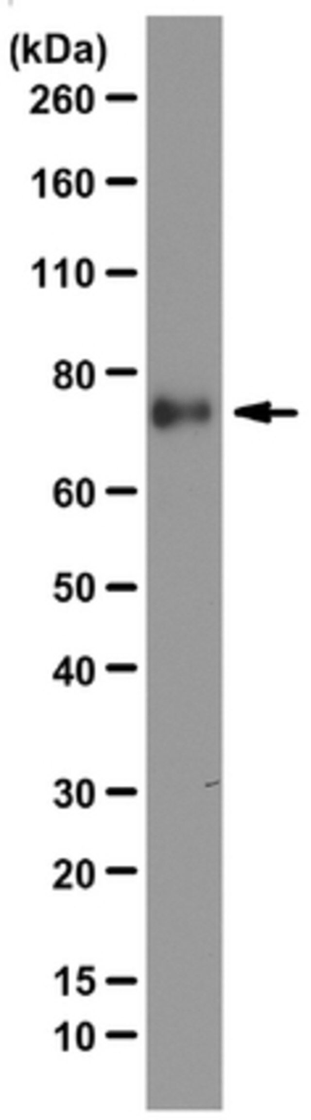 Anti-Kindlin-1 Antibody, clone 4A5.14