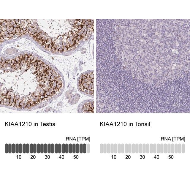 Anti-KIAA1210 antibody produced in rabbit