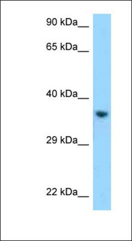 Anti-KIR2DL1 antibody produced in rabbit