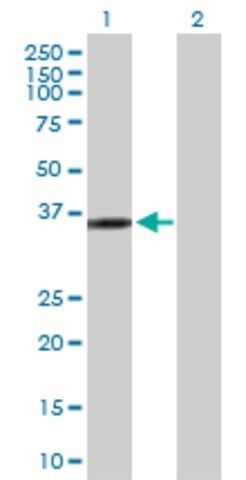 Anti-KIF6 antibody produced in rabbit