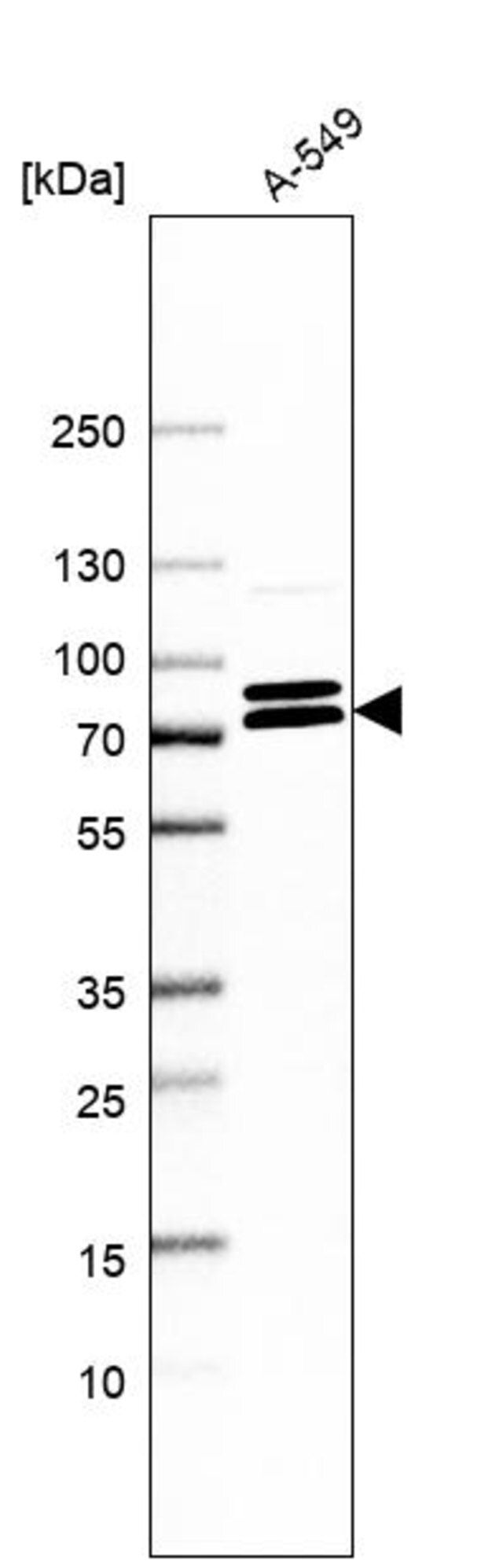 Anti-KIFC3 antibody produced in rabbit