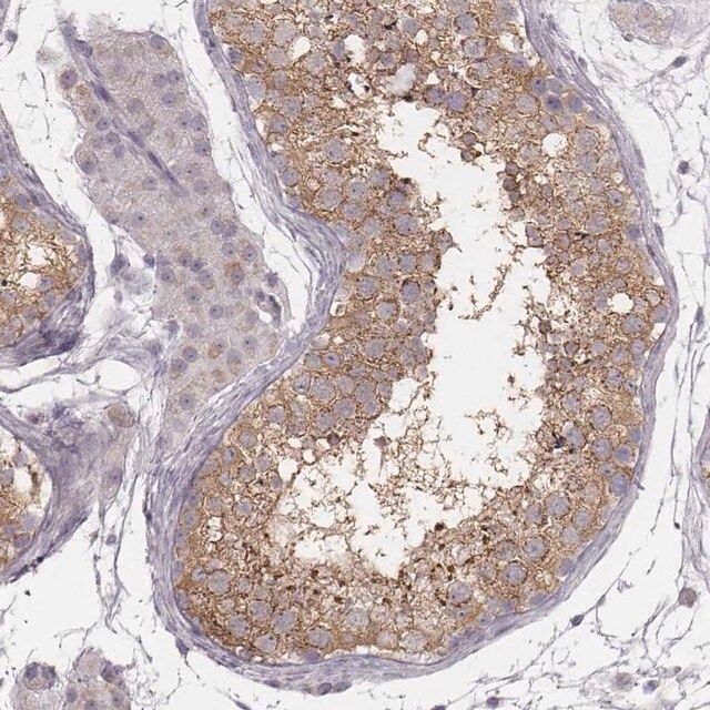 Anti-KIF5C antibody produced in rabbit