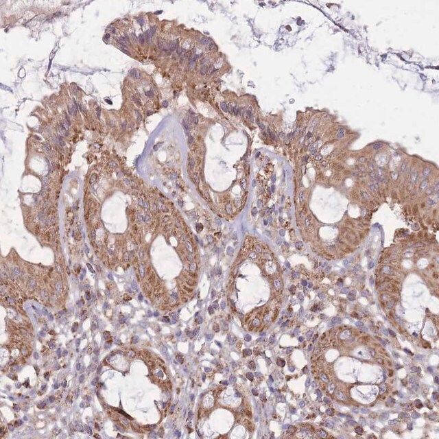 Anti-KIF16B antibody produced in rabbit