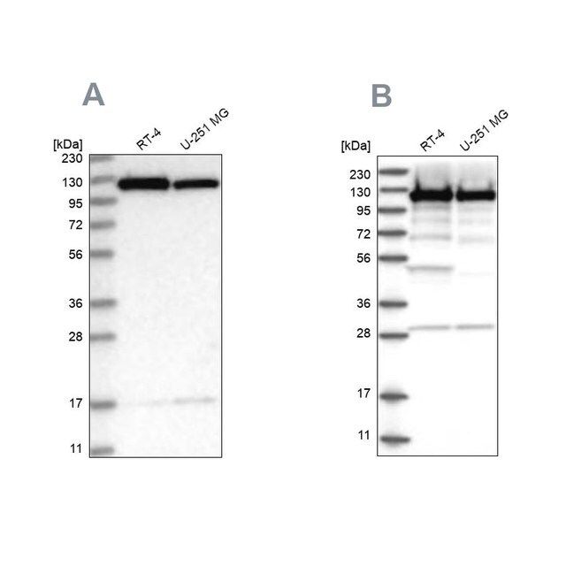 Anti-KIF5B antibody produced in rabbit