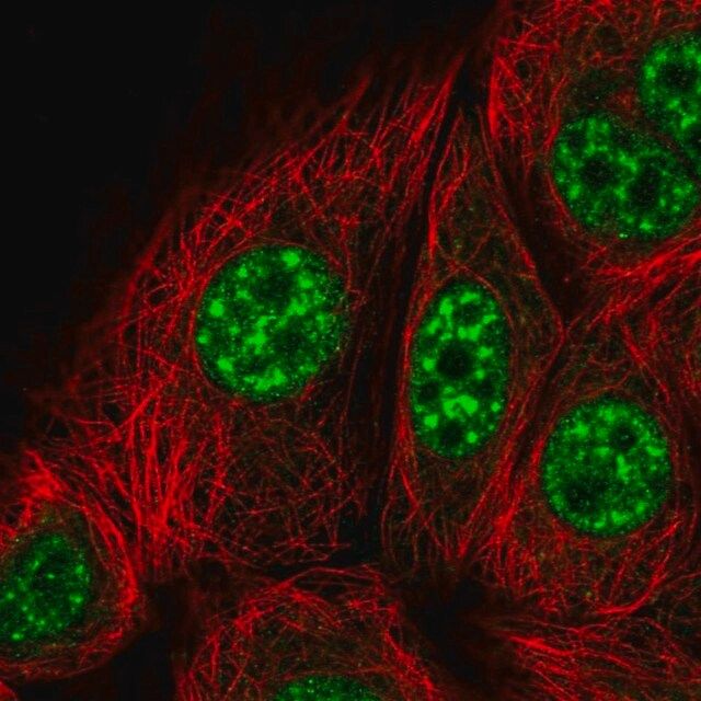 Anti-KIF22 antibody produced in rabbit