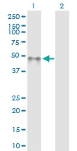 Anti-KIR2DL5A antibody produced in rabbit