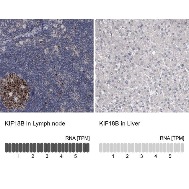 Anti-KIF18B antibody produced in rabbit