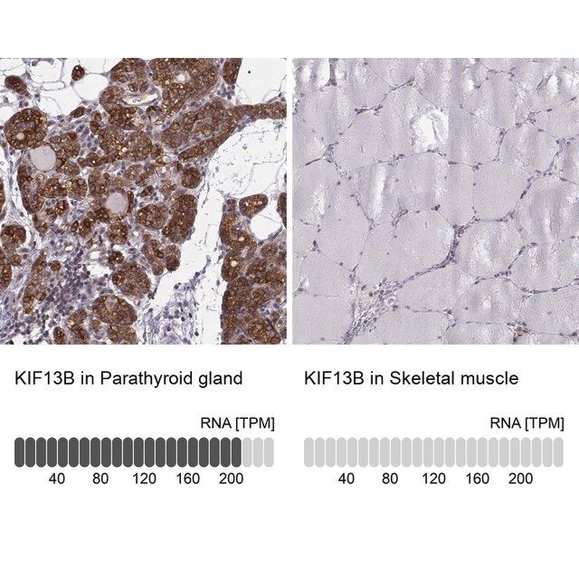 Anti-KIF13B