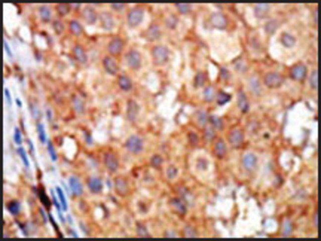 Anti-KIP2 (C-term) antibody produced in rabbit