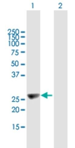 Anti-KIFC2 antibody produced in mouse