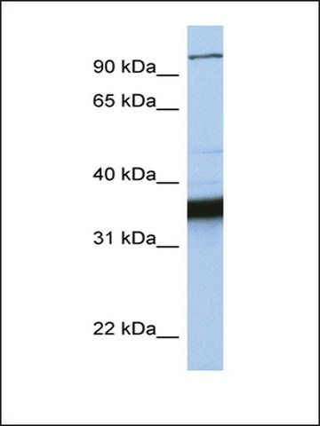 Anti-KIFC3 antibody produced in rabbit