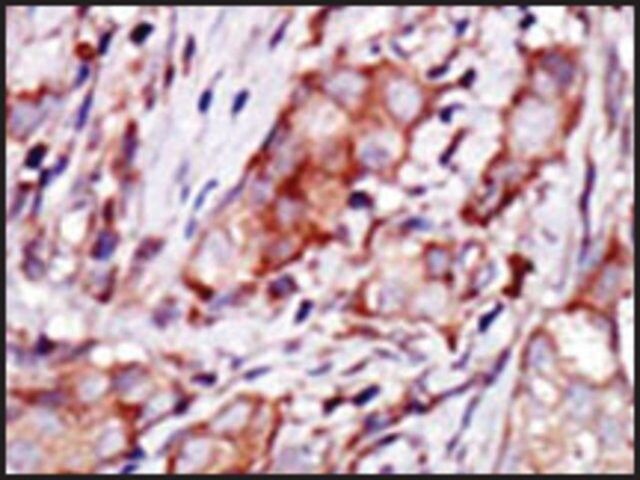 Anti-KIP2 (N-term) antibody produced in rabbit