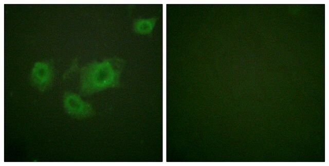 Anti-KIR6.2 (PHOSPHO-THR224)