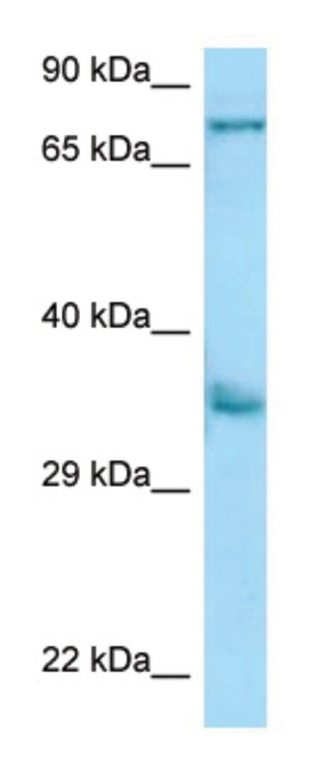 Anti-KIR2DS2 (N-terminal) antibody produced in rabbit