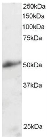 Anti-KLF8/BKLF3 antibody produced in goat