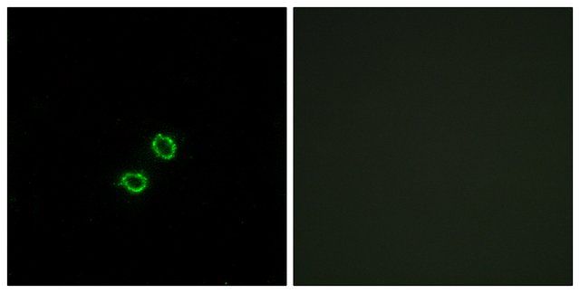 Anti-KIR2DL5B antibody produced in rabbit