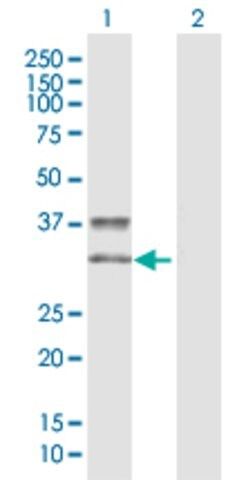 Anti-KIR2DS3 antibody produced in rabbit