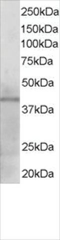 Anti-KLF3/BKLF antibody produced in goat