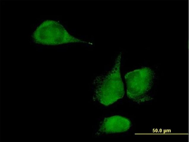 Anti-KLHDC4 antibody produced in mouse