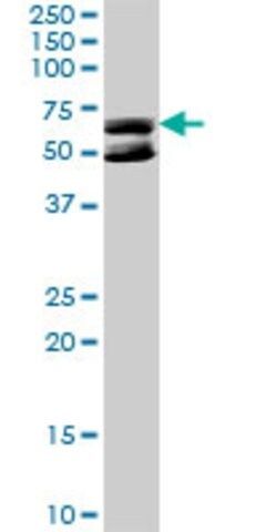 Anti-KLHDC4 antibody produced in rabbit