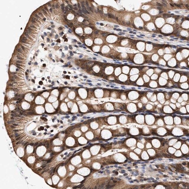 Anti-KLHDC1 antibody produced in rabbit