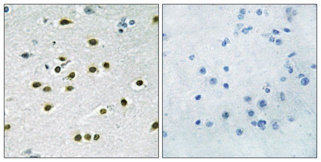 Anti-KLF10, C-Terminal antibody produced in rabbit