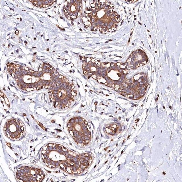 Anti-KLHDC4 antibody produced in rabbit