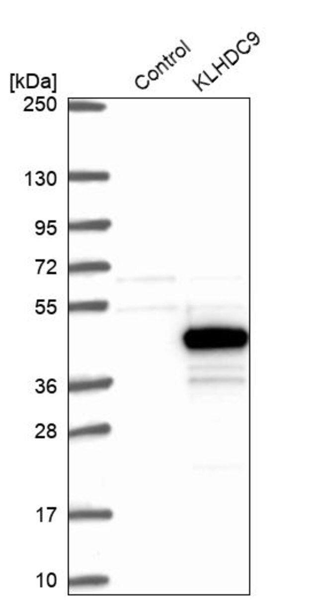 Anti-KLHDC9 antibody produced in rabbit